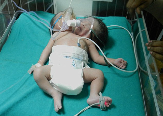 Baby-2 heads-2...